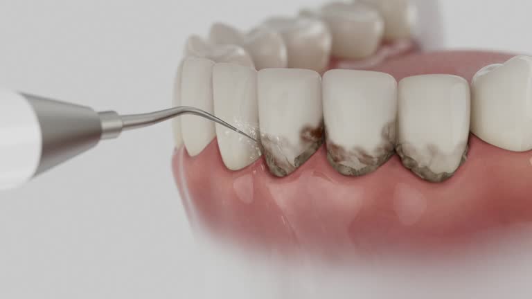 Trusted Emergency Dentist service in Hillsboro, OH - Dentist Open Now